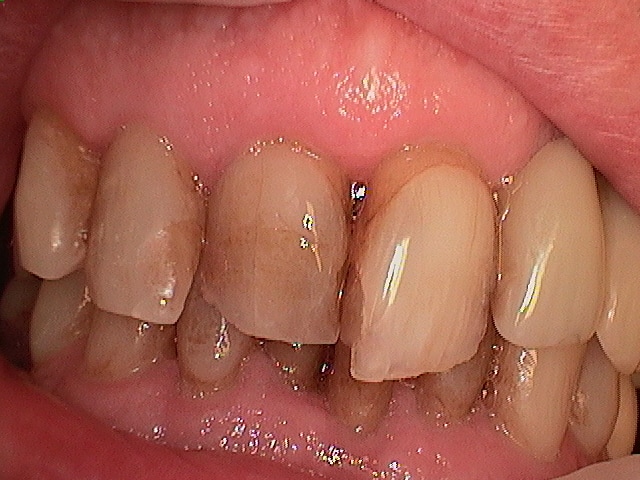 Drmonicamehring dds bb after