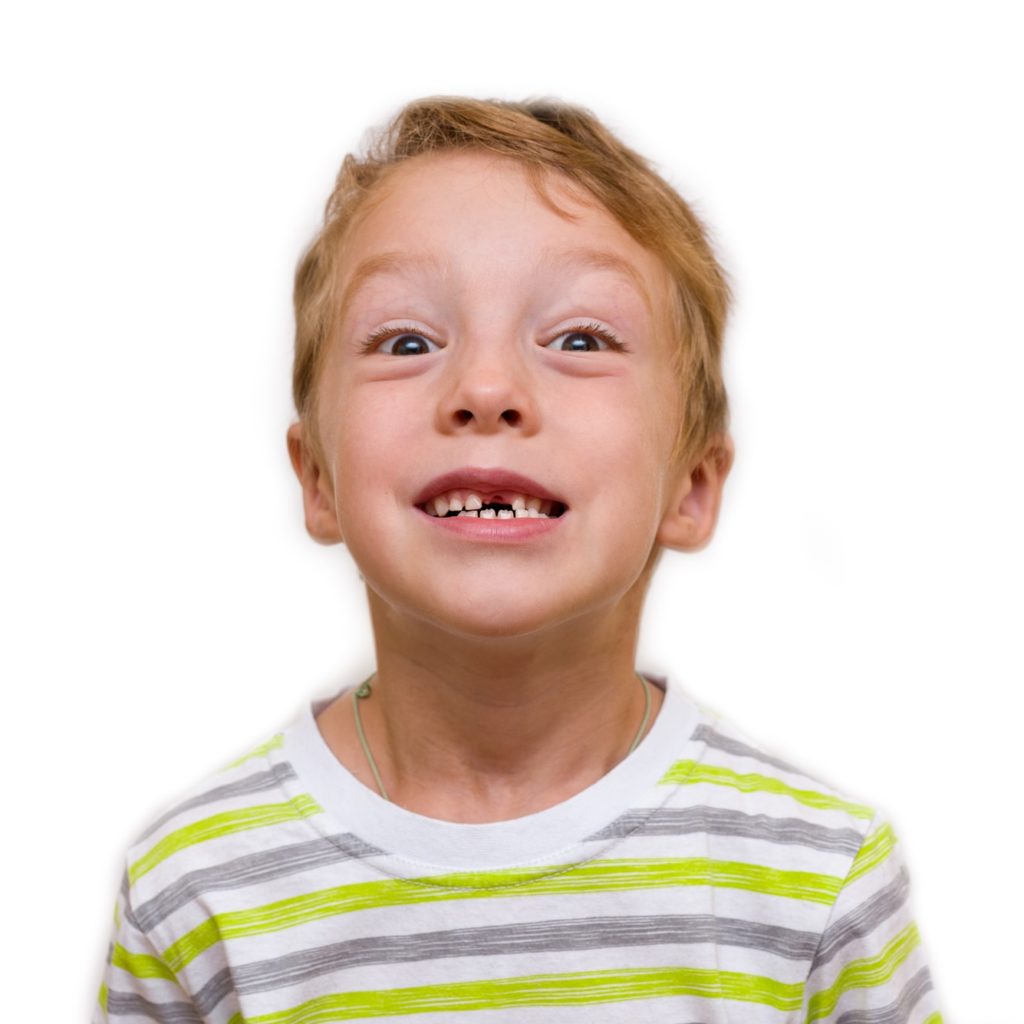 A kid smiling to show a missing tooth